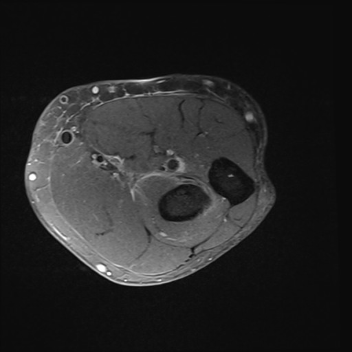 Click on the Serie image to view the images of Wieszt, Gnter